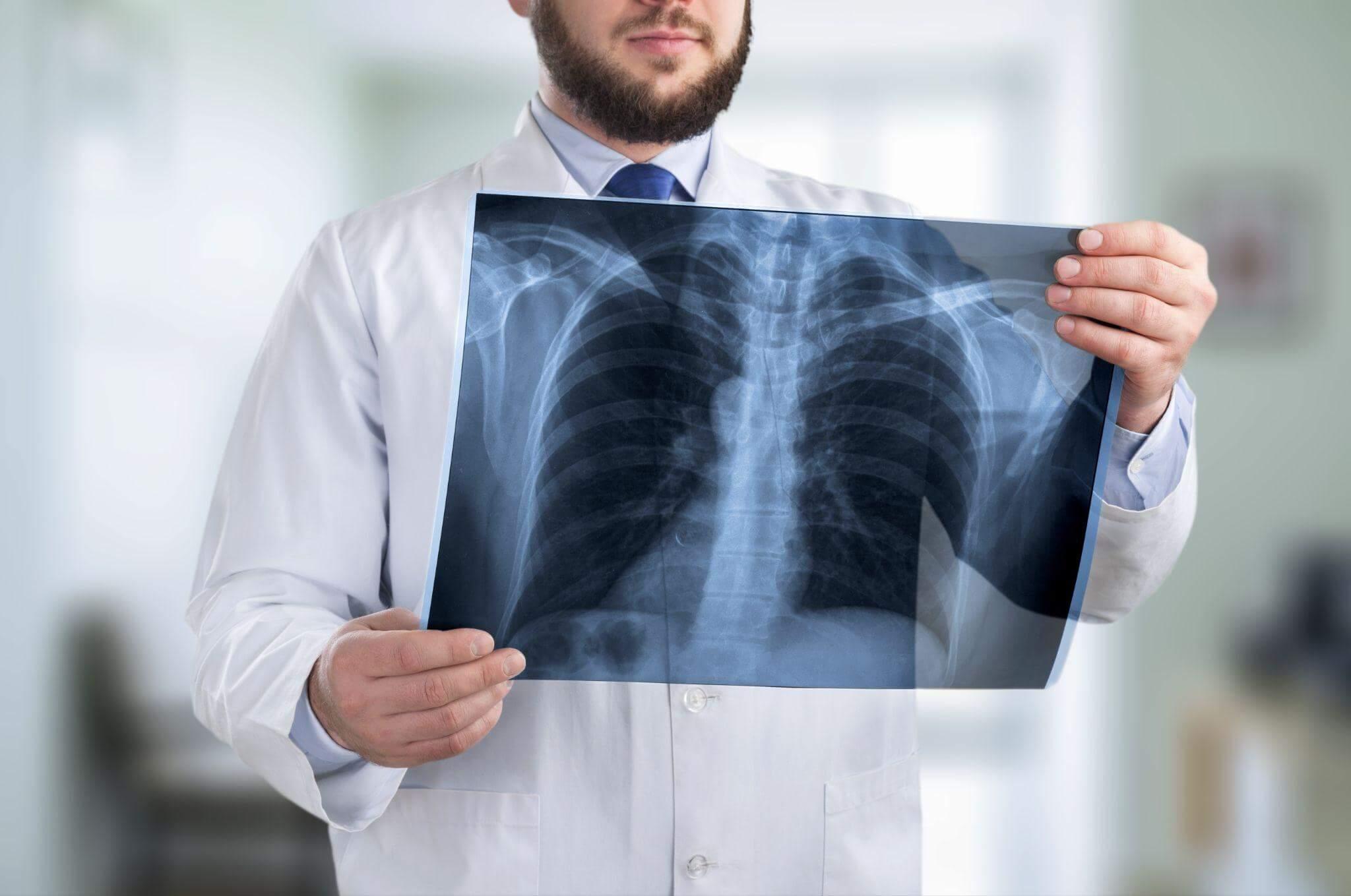 a man holding up a x - ray picture of a chest